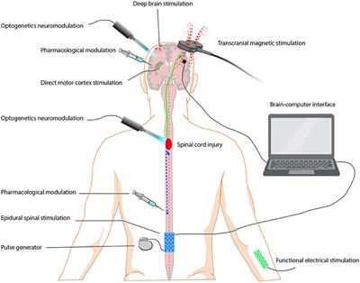 Restoring Sensorimotor Function Through Neuromodulation After Spinal Cord Injury: Progress and Remaining Challenges